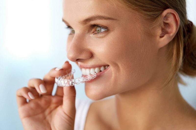 ŞEFFAF PLAKLARLA ORTODONTİ (INVISALIGN)